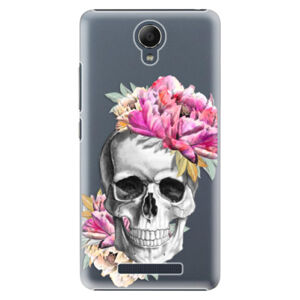 Plastové puzdro iSaprio - Pretty Skull - Xiaomi Redmi Note 2